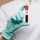 BMC Medicine: врачи предупредили о группе крови, грозящей развитием диабета