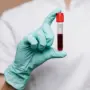 BMC Medicine: врачи сняли вопрос группы крови, грозящей развитием диабета